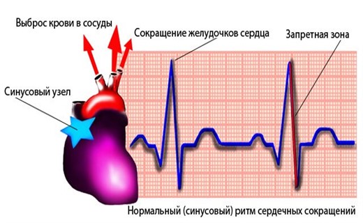 Центр нарушения сердечного ритма
