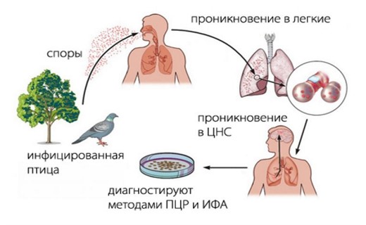 Орнитоз у ребенка