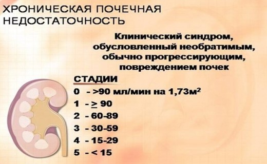 Хроническая почечная недостаточность