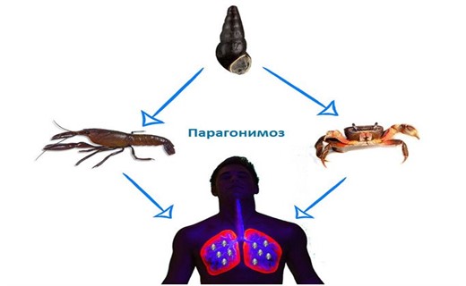 Парагонимоз легких