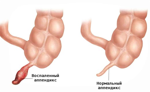 У ребенка болит выше живота