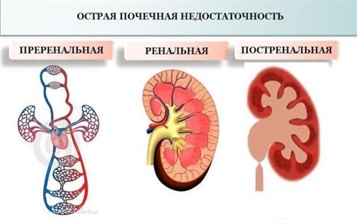 Показатели почечной недостаточности