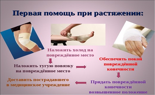 Лечение при растяжении в домашних условиях 932