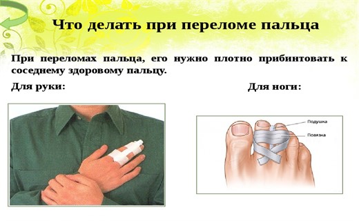 Травма пальца руки