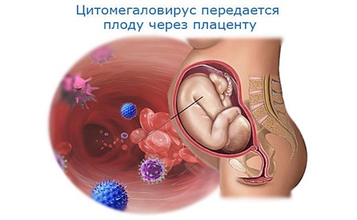 Вирус цитомегаловирус лечение