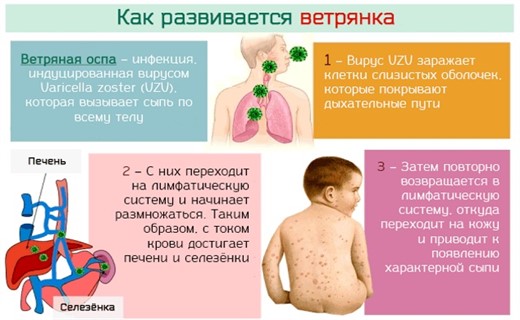 Начало ветрянки у детей фото