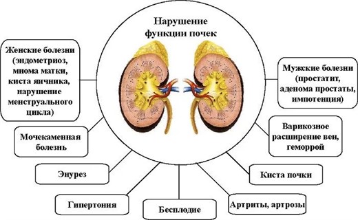 Причины заболевания почек