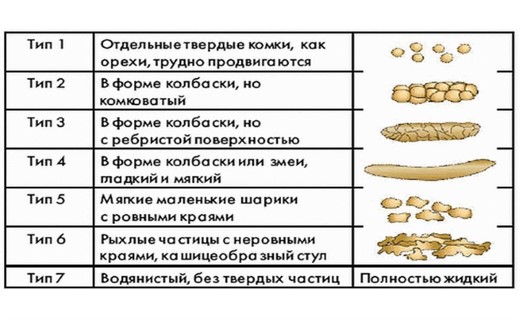 Кал при запоре