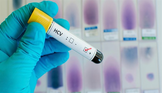 Вирус гепатита с hcv при беременности thumbnail