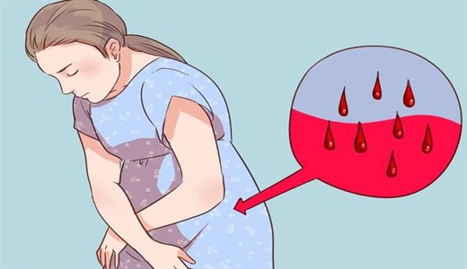 Кровотечение во время беременности