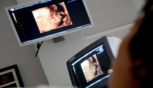 На каком сроке делают первый скрининг при беременности