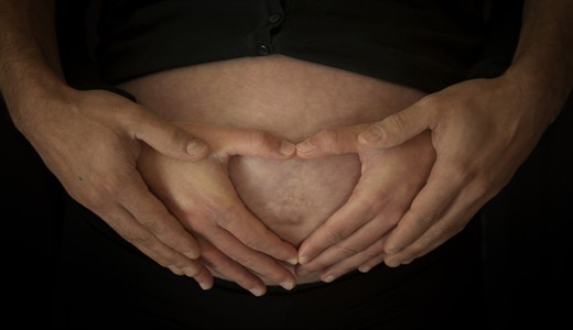 Пигментные пятна при беременности