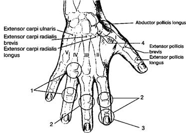 Массаж рук при артрозе рук