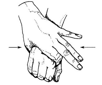 Массаж рук при артрозе рук