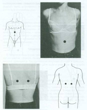 Точки на теле от болей в желудке