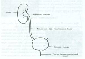 Акупунктура при камнях в почках