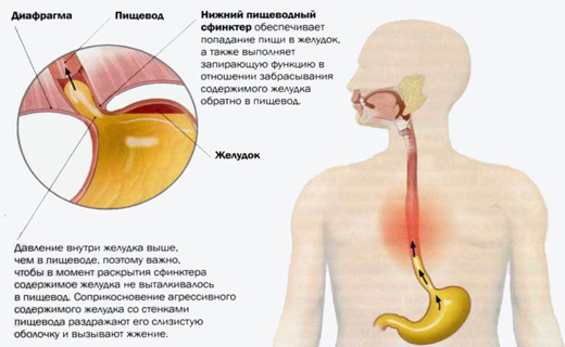 причины