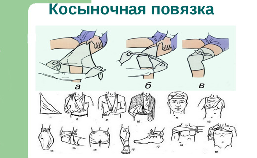 Виды повязок и способы их наложения с картинками