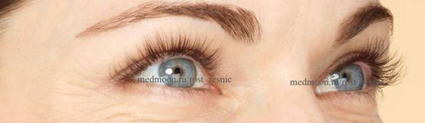 Magic Glance INTENSIVE