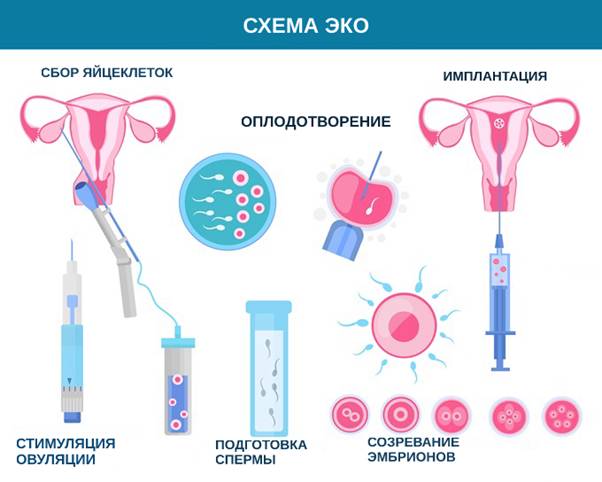 Как происходит искусственное оплодотворение?