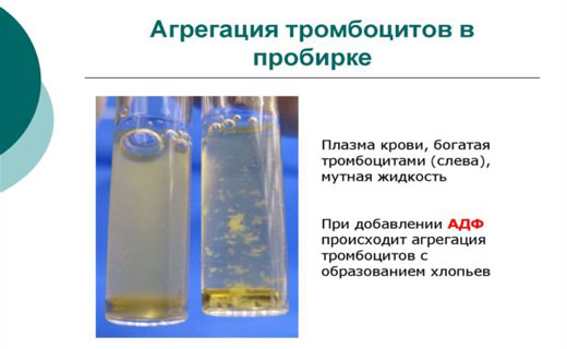 биола анализатор агрегации тромбоцитов
