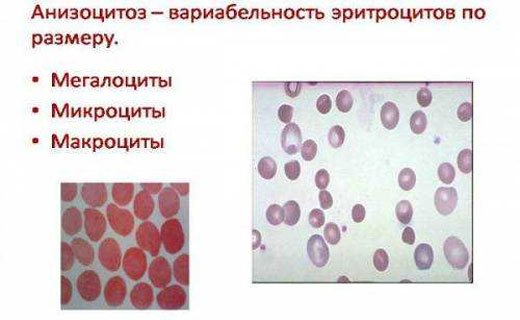 анизацитоз тромбоцитов