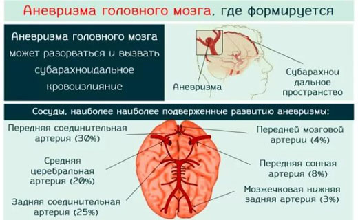 гловной мозг