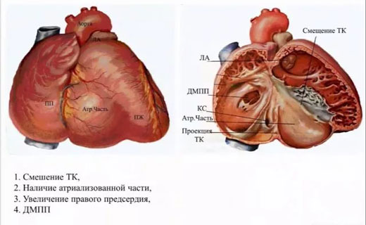 болезнь сердца