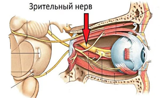 атрофия картинка зрительного нерва