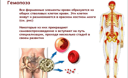 Гемопоэз симптомы и признаки