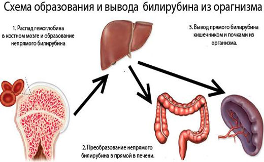 симптомы гипербилирубинемии