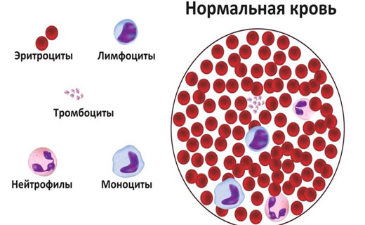 Агранулоцитоз симптомы