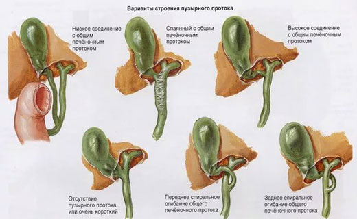 Как быстро снять воспаление желчного Дискинезия желчевыводящих путей симптомы и причины Типы дискинезии желчевыводящи