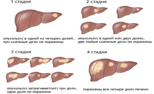 желтуха