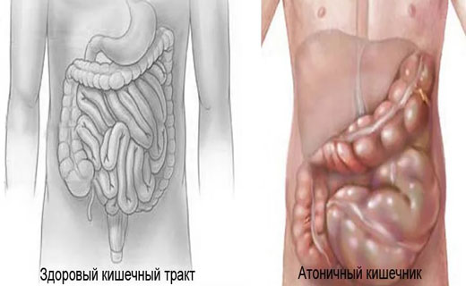 печень