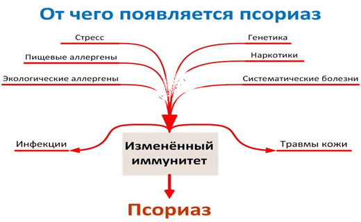 Кожный псориаз лечение