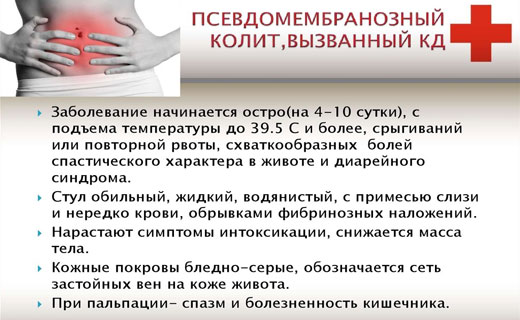 псевдомембранозный колит - как его распознать