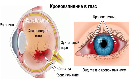 почему краснеют глаза