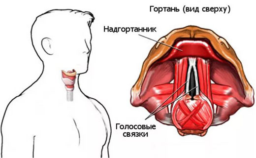 ларингит