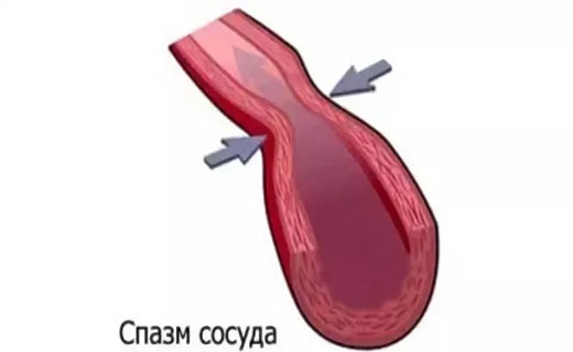 болезнь сердца