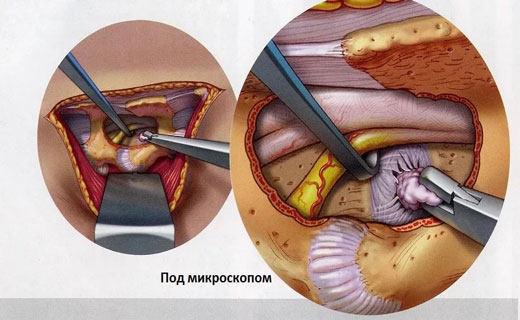 болезни позвоночника