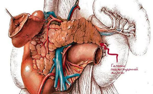 панкреатит