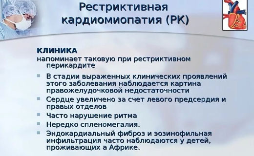 кардиомиопатия