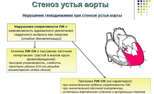 гловной мозг 