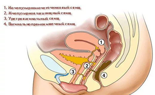 Лечение ушного свища народными средствами thumbnail