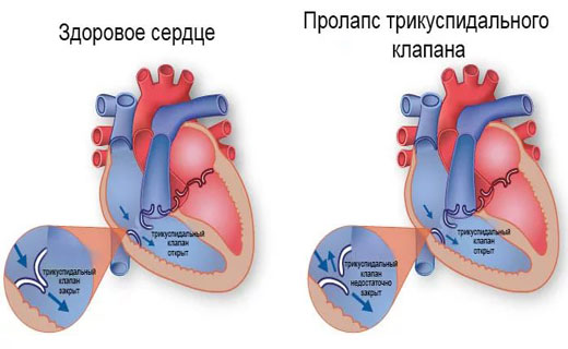 недостаточность