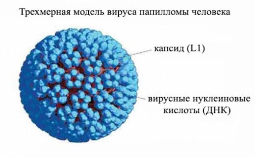 папиллома