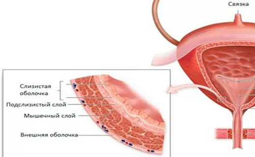 мочевой пузырь