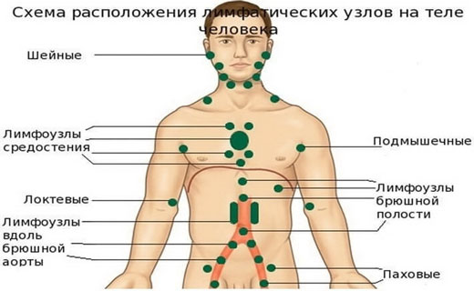 инфекции