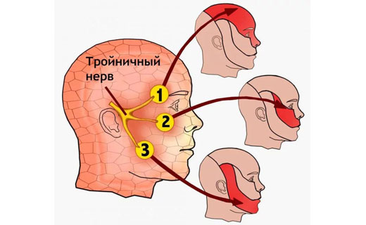 троичный нерв